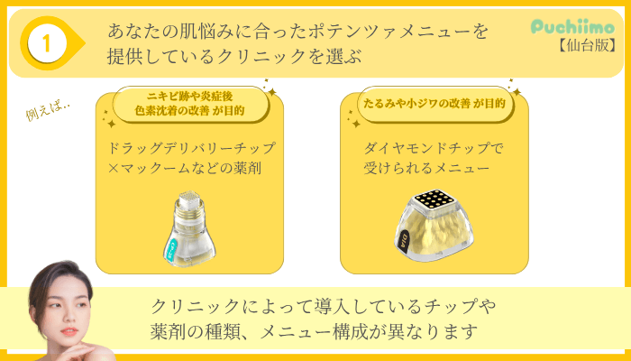 ポテンツァ選び方ポイント1仙台