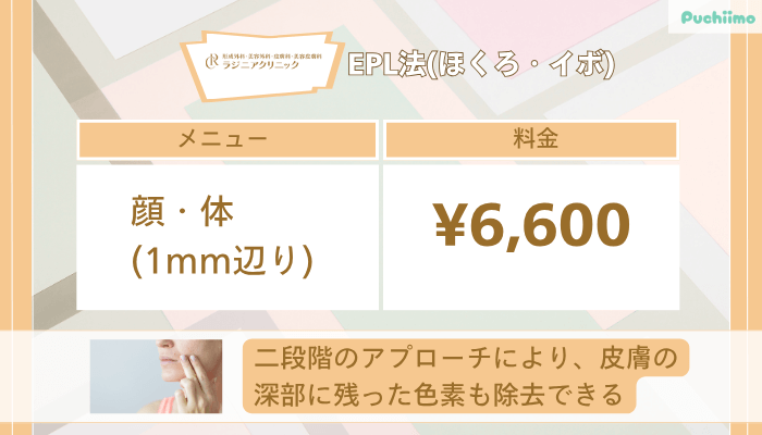 ラジニアクリニックEPL法ほくろ・イボ