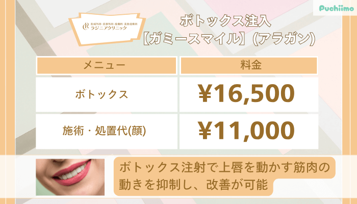 ラジニアクリニックボトックス注入【ガミースマイル】アラガン