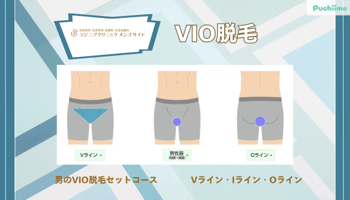 ラジニアクリニックメンズVIO脱毛