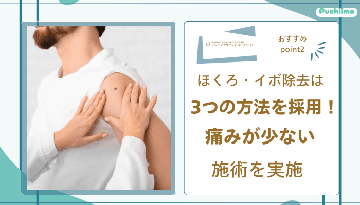 ラジニアクリニックメンズおすすめポイント2
