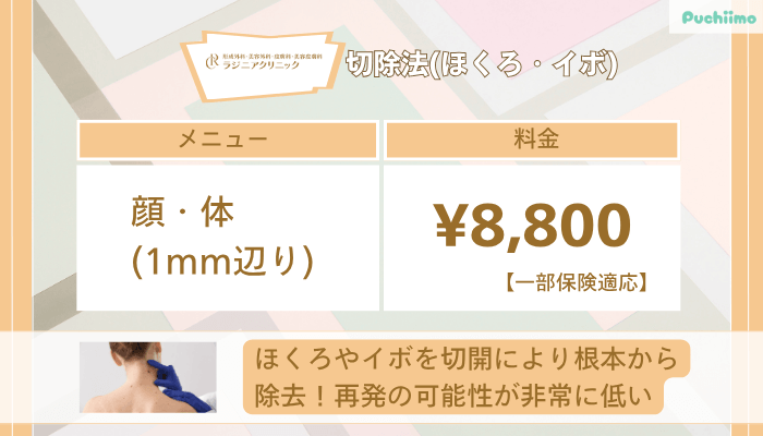 ラジニアクリニック切除法ほくろ・イボ