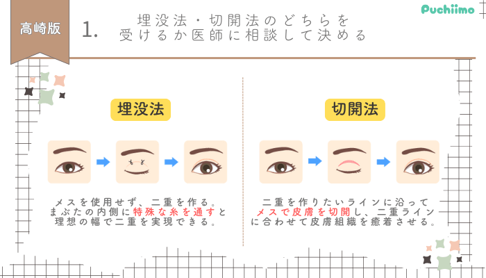二重整形高崎選び方1