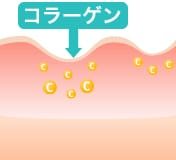 品川スキンクリニックダーマペンメカニズム2