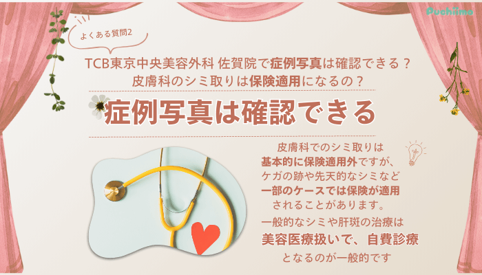 TCB佐賀ピコレーザーよくある質問2