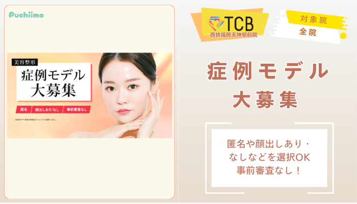 TCB西鉄福岡天神駅前ピコレーザー美容整形症例モデル大募集