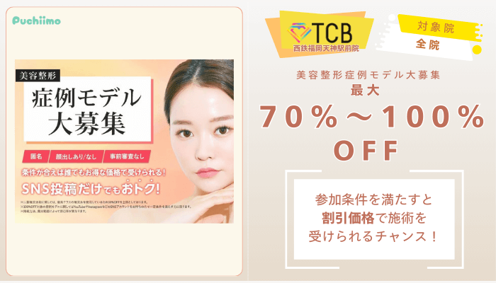 TCB西鉄福岡天神駅前ピコレーザー美容整形症例モデル大募集