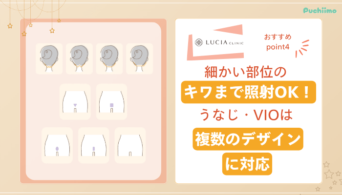 ルシアクリニック医療脱毛おすすめポイント4