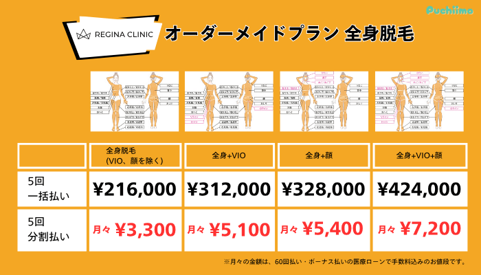 レジーナクリニック医療脱毛オーダーメイドプラン全身脱毛料金