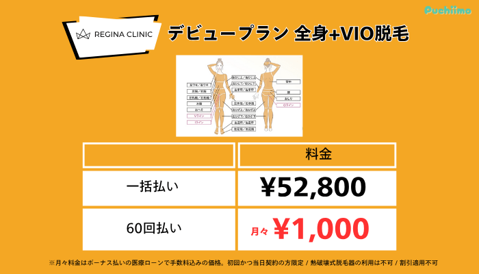レジーナクリニック医療脱毛デビュープラン全身VIO脱毛料金