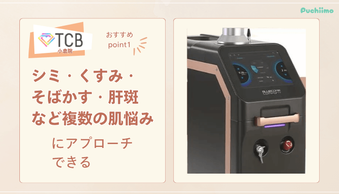 TCB小倉ピコレーザーおすすめポイント1