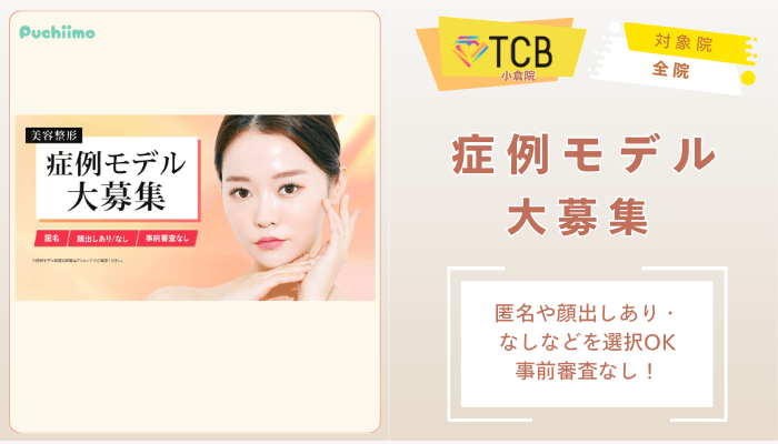 TCB小倉ピコレーザー美容整形症例モデル大募集