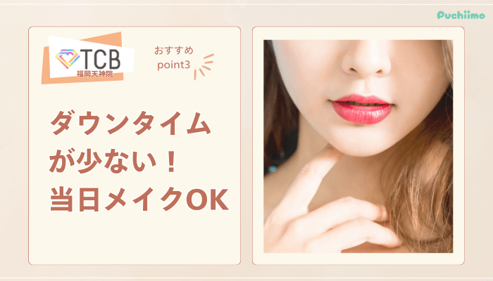 TCB福岡天神ピコレーザーおすすめポイント3