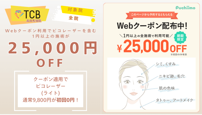 TCB高田馬場ピコレーザーWebクーポン