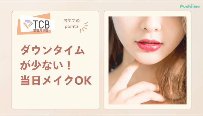 TCB高田馬場ピコレーザー魅力3