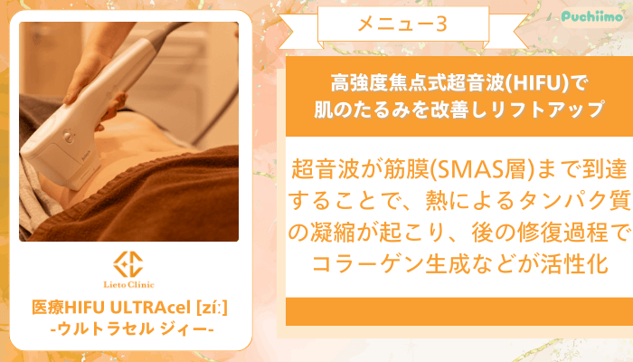 リエートクリニックメニュー3