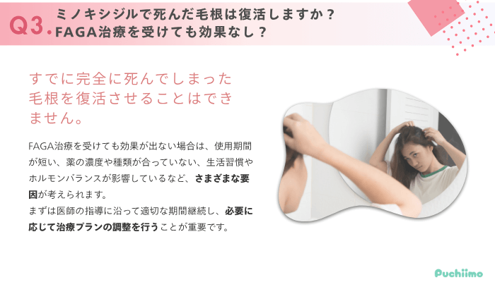 DMMオンラインクリニックFAGAよくある質問3