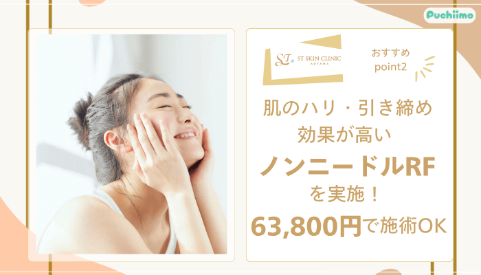 STスキンクリニック青山ポテンツァおすすめポイント2