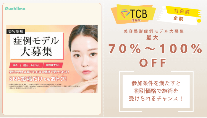 TCB徳島ピコレーザー美容整形症例モデル大募集