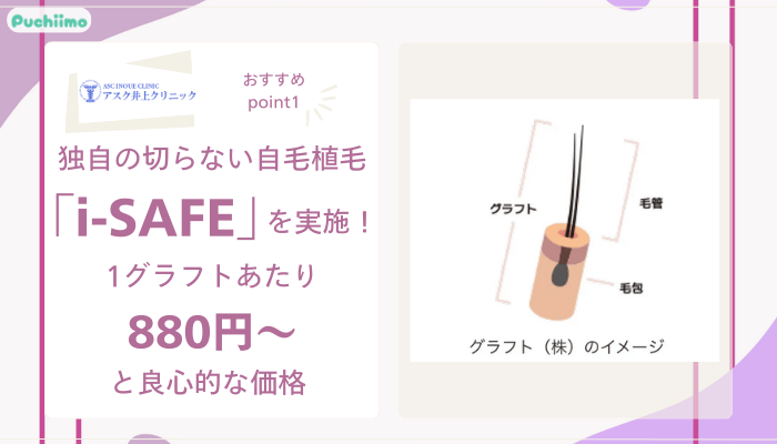 アスク井上クリニック女性薄毛治療おすすめポイント1