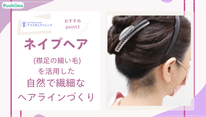 アスク井上クリニック女性薄毛治療おすすめポイント3