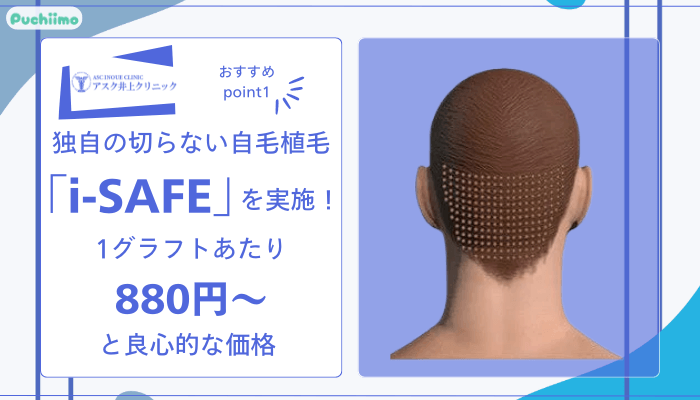 アスク井上クリニック男性薄毛治療おすすめポイント1