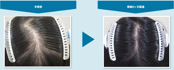 アスク井上クリニック症例1