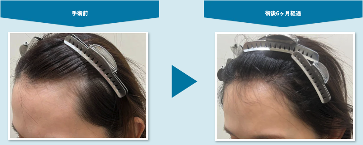 アスク井上クリニック症例2