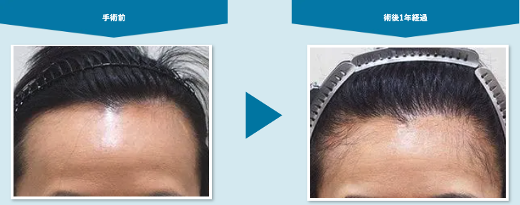 アスク井上クリニック症例3