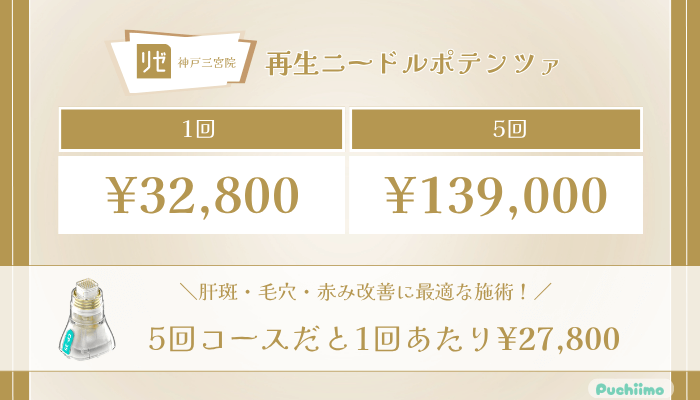 リゼクリニック神戸三宮再生ニードルポテンツァの料金