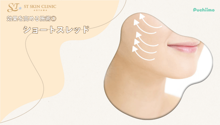 STスキンクリニック青山ハイフ効果を高める施術1