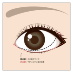 アナザークリニック銀座たれ目デザインA