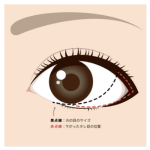 アナザークリニック銀座たれ目デザインB