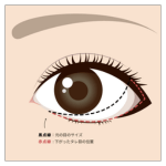 アナザークリニック銀座たれ目デザインC