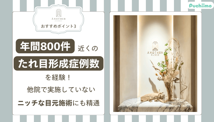 アナザークリニック銀座たれ目形成おすすめポイント3