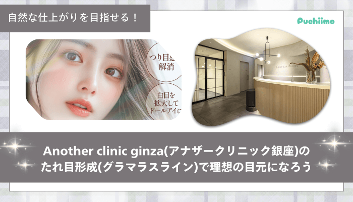 アナザークリニック銀座たれ目形成まとめ