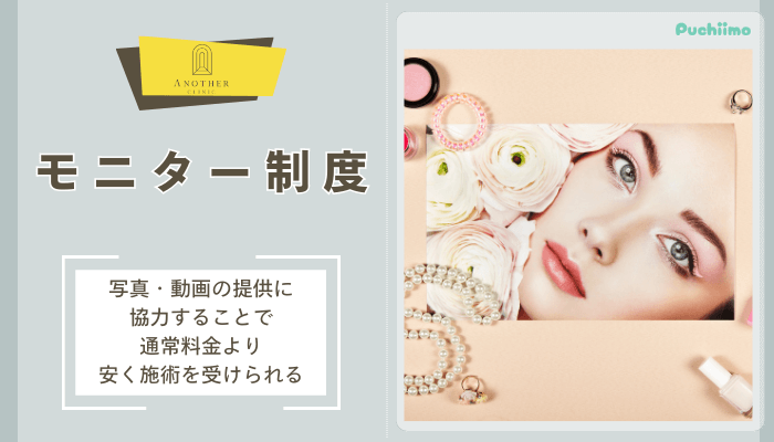 アナザークリニック銀座たれ目形成モニター制度