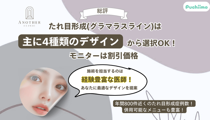 アナザークリニック銀座たれ目形成総評