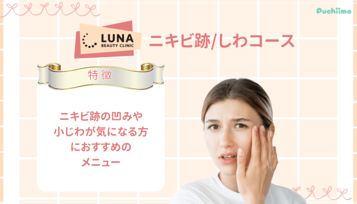 ルナビューティークリニックポテンツァニキビ跡_しわコース
