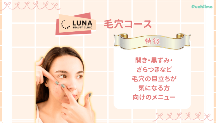 ルナビューティークリニックポテンツァ毛穴コース
