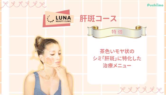 ルナビューティークリニックポテンツァ肝斑コース