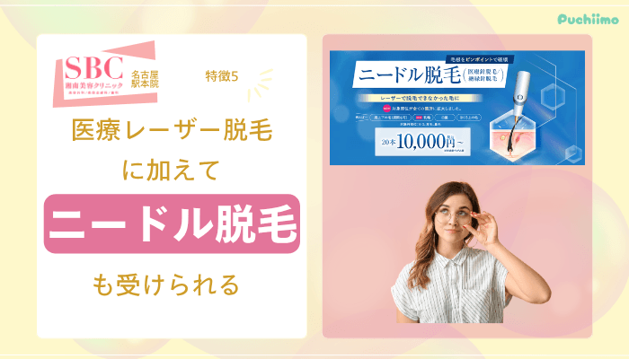 SBC名古屋駅医療脱毛おすすめポイント5