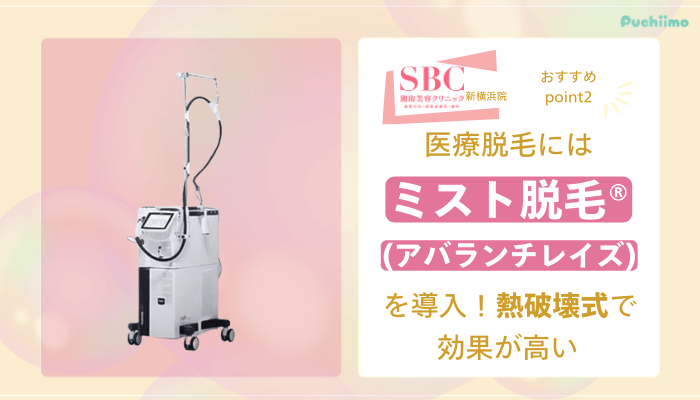 SBC新横浜医療脱毛おすすめポイント2
