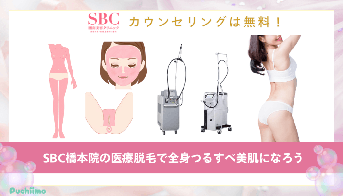 SBC橋本医療脱毛まとめ