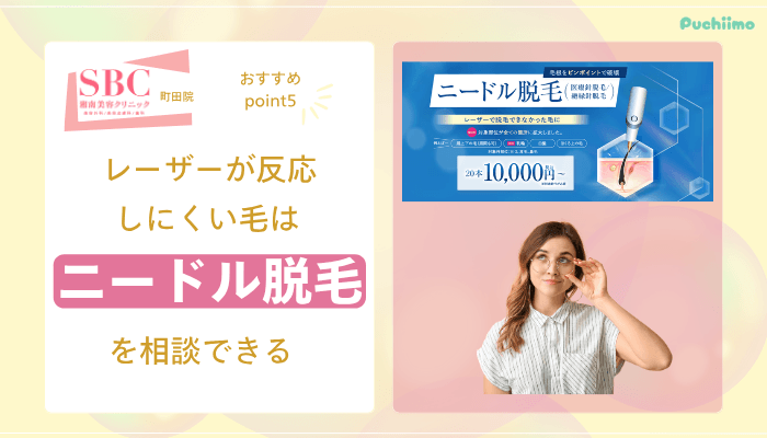 SBC町田医療脱毛おすすめポイント5