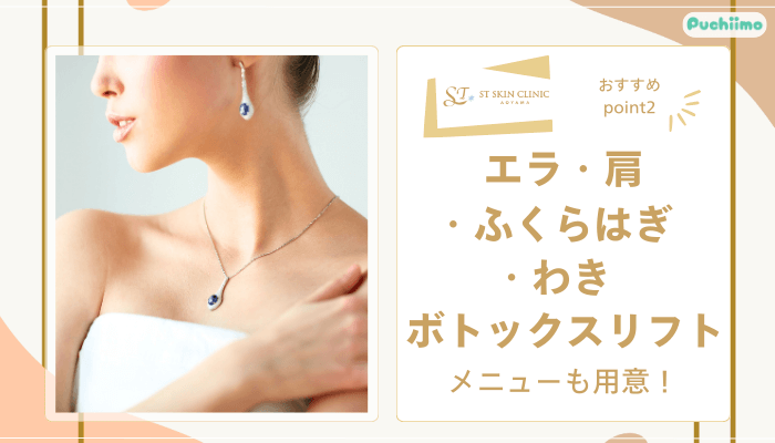 STスキンクリニック青山ボトックスおすすめポイント2