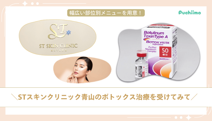 STスキンクリニック青山ボトックスまとめ