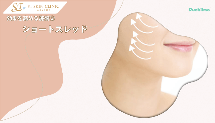STスキンクリニック青山ボトックス効果を高める施術3