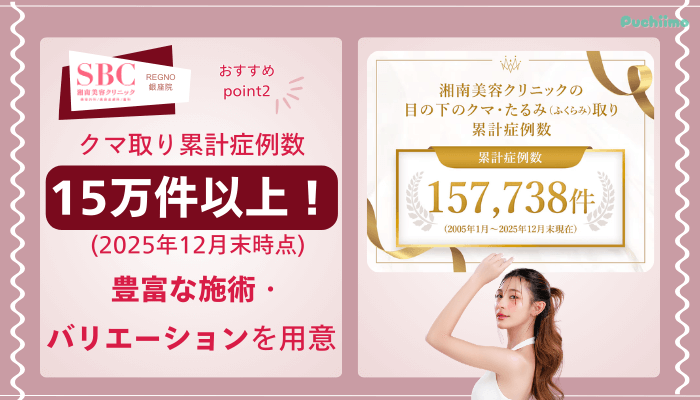 SBCRegno銀座クマ取りおすすめポイント2