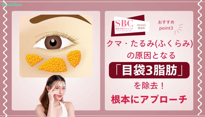 SBCRegno銀座クマ取りおすすめポイント3